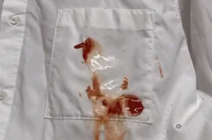 e-Smile「ヘのカッパ超撥水スプレー」